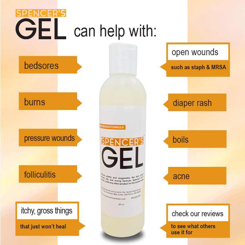 Spencer’s Gel (4oz)