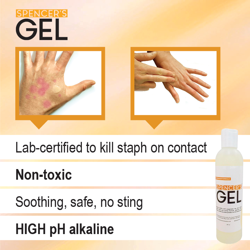 Spencer’s Gel (4oz)